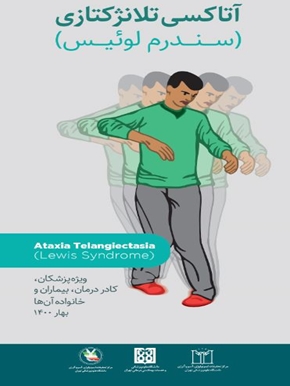 آتاکسی تلانژکتازی 