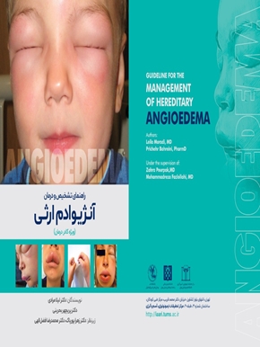راهنمای تشخیص و درمان آنژیوادم ارثی